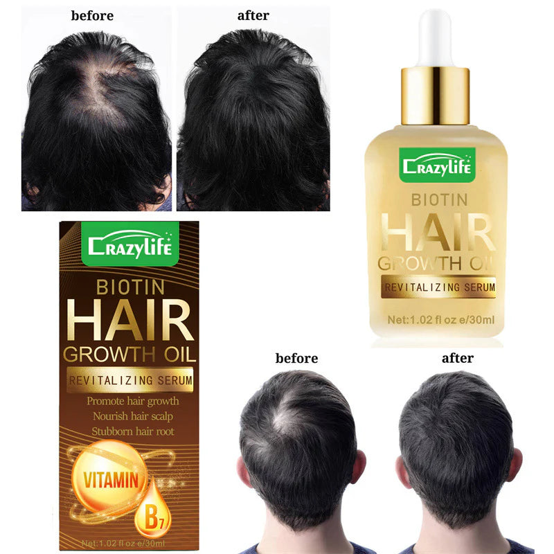 Biotin Gentle Hair Nourishing Oil 