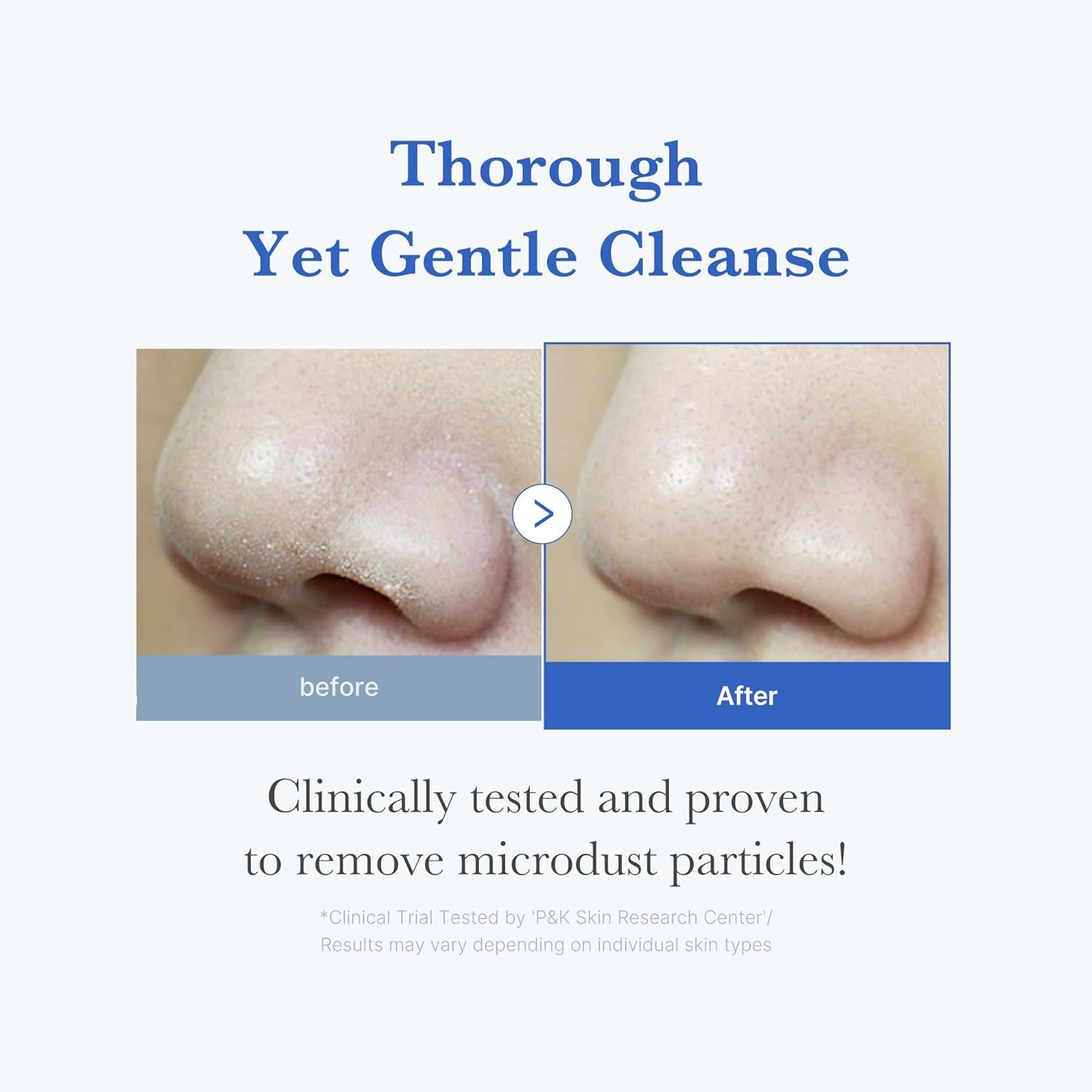 Zero Foam Cleanser for Sensitive Skin - Sebum Control, Moisture Balance, and Pore Minimization