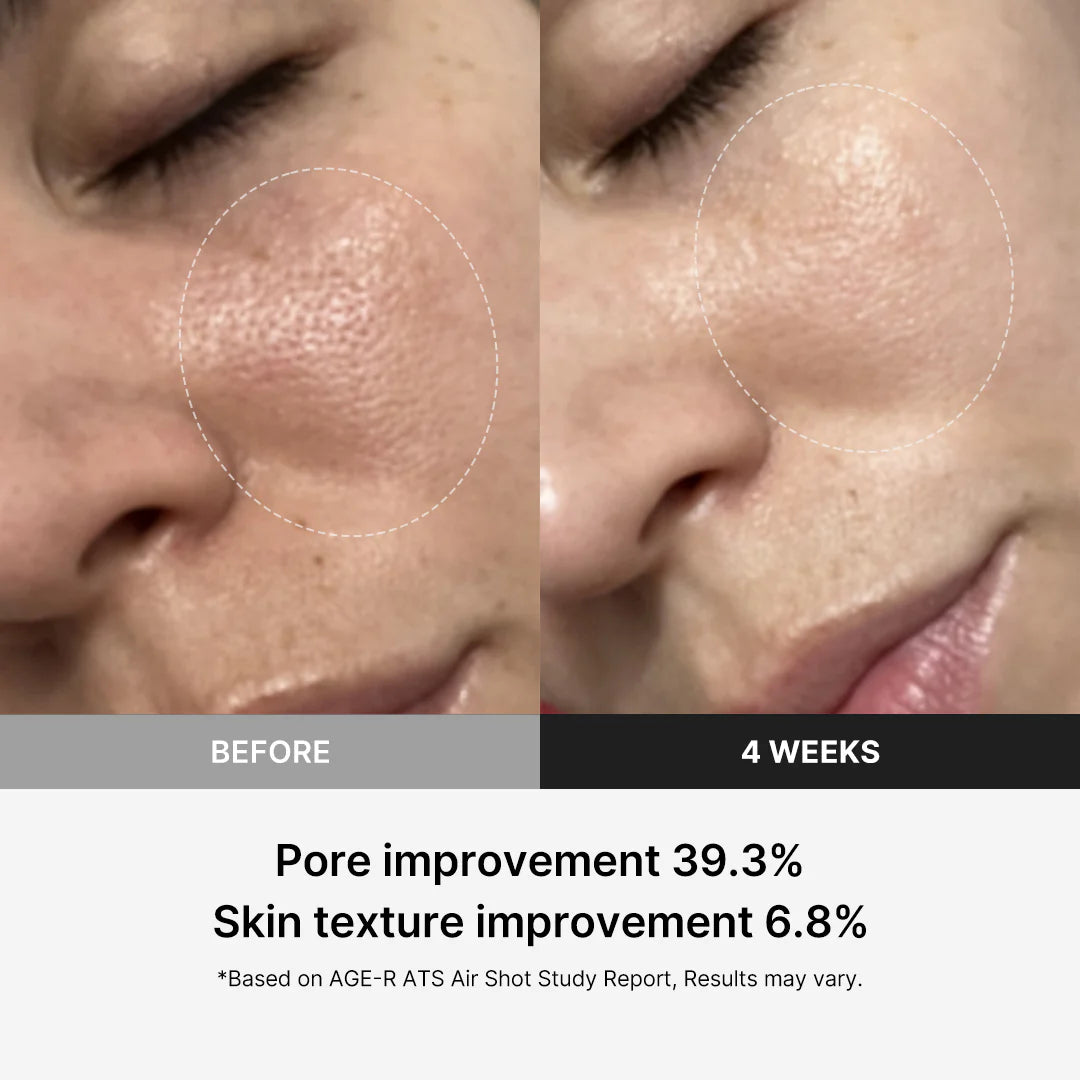 Medicube Age-R ATS Air Shot - Microneedling Skin Care Device