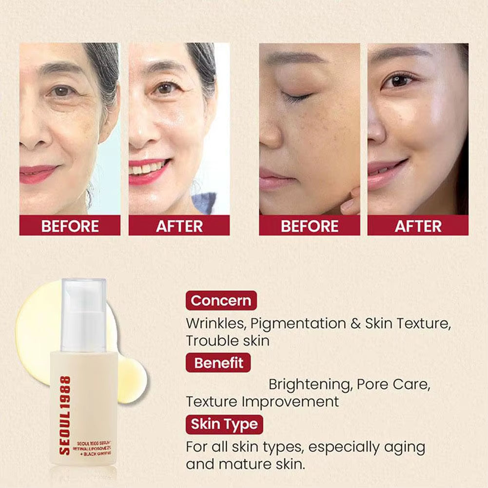 Seoul 1988 Eye Cream: Retinal Liposome 4% +Fermented Bean