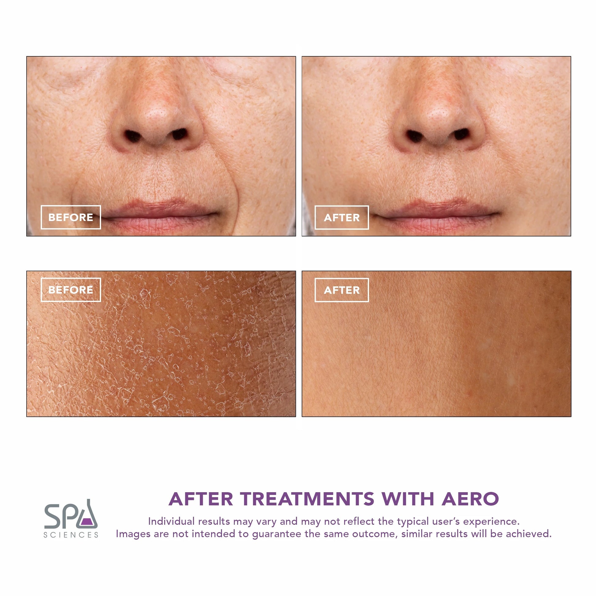 AERO, 3-In-1 Skincare Infusion Device for Anti-Aging and Maximum Skincare Absorption